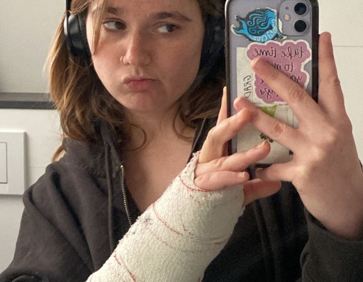How a Broken Wrist in Barcelona Taught Me Resilience